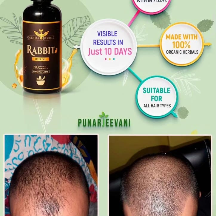 Rabit Herbal Hair Oil - 100% Original